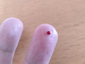 指先から血が出る様子