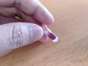 採血管に血が溜まった様子